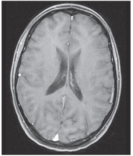 <strong>Study this image.Identify the imaging plane and modality. </strong> A) MRI,sagittal B) CT,sagittal C) MRI,axial D) CT,axial