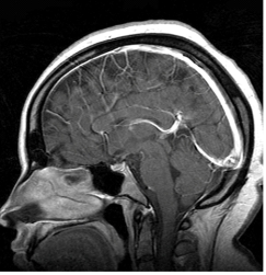 <strong>What imaging plane is presented in this image? </strong> A) Sagittal B) Axial C) Oblique D) Coronal
