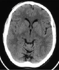 <strong>Which imaging modality produced this image? </strong> A) CT B) MRI C) Radiography D) Ultrasound