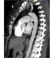 <strong>Examine the image below.The line points to the: </strong> A) stomach. B) liver. C) kidney. D) heart.
