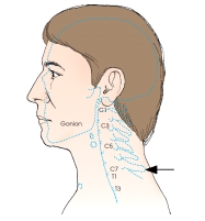 <strong>The external landmark indicated by the arrow in this figure is the: </strong> A) mastoid tip. B) vertebra prominens. C) gonion. D) transverse process.