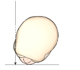 <strong>Identify the x-ray projection illustrated in this figure. </strong> A) Tangential B) PA axial oblique. C) Orbitoparietal D) Parietoorbital