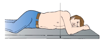 <strong>The patient in this figure is placed in which position? </strong> A) RPO B) LPO C) RAO D) LAO