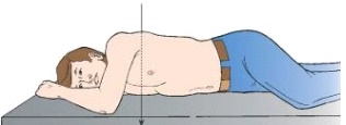 <strong>The body position depicted below results in which x-ray projection? </strong> A) PA oblique B) AP oblique C) Recumbent D) Mediolateral