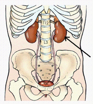 <strong>The organ identified in the figure below is the: </strong> A) spleen. B) liver. C) left kidney. D) right kidney.