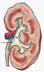 <strong>The area of the kidney identified in the figure below is the: </strong> A) hilum. B) renal pelvis. C) renal sinus. D) minor calyx.