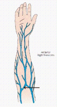 <strong>What vein,often used for venipuncture,is labeled with the arrow in the diagram below? </strong> A) Basilic vein B) Cephalic vein C) Radial vein D) Median cubital vein
