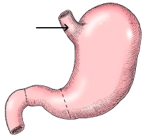 <strong>The area identified in the figure below is the: </strong> A) fundus. B) angular notch. C) cardiac antrum. D) lesser curvature.