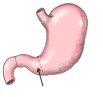 <strong>The part of the stomach identified in the figure below is the: </strong> A) greater curvature. B) pyloric antrum. C) pyloric canal. D) pyloric sphincter.