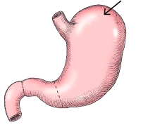 <strong>The area identified in the figure below is the: </strong> A) fundus. B) body. C) cardiac antrum. D) greater curvature.