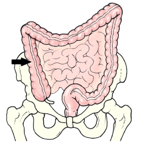 <strong>The area of the colon identified in the figure below is the: </strong> A) left colic flexure. B) right colic flexure. C) ascending colon. D) descending colon.