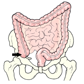 <strong>The area of the colon identified in the figure below is the: </strong> A) cecum. B) ileum. C) sigmoid. D) rectum.