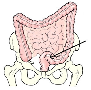 <strong>The area of the colon identified in the figure below is the: </strong> A) cecum. B) ileum. C) rectum. D) sigmoid.