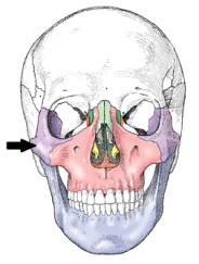 <strong>The bone indicated in the figure below is the: </strong> A) parietal. B) orbital. C) temporal. D) zygoma.