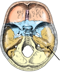 <strong>The part of the cranial base identified in the figure below is the: </strong> A) auditory canal. B) dorsum sellae. C) greater wing. D) petrous portion.
