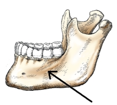<strong>The part of the mandible identified in the figure below is the: </strong> A) body. B) ramus. C) symphysis. D) alveolar portion.