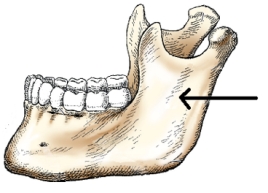<strong>The portion of the mandible identified in the figure below is the: </strong> A) body. B) ramus. C) symphysis. D) alveolar portion.