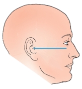 <strong>The topographic line identified in the figure below is the: </strong> A) orbitomeatal. B) mentomeatal. C) acanthiomeatal. D) infraorbitomeatal.