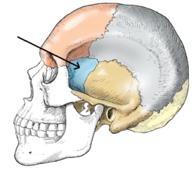 <strong>The bone identified on the skull below is the: </strong> A) temporal. B) parietal. C) zygoma. D) sphenoid.