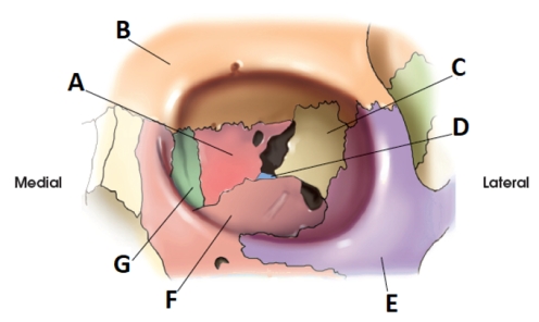 <strong>Letter E in the diagram below of the orbit labels the: </strong> A) sphenoid. B) zygoma. C) maxilla. D) frontal.