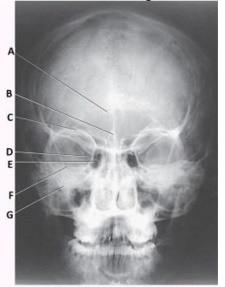 Letter F in the image below used to evaluate the cranium labels the: