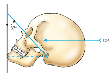 The figure below demonstrates the _____ method.