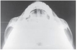 What projection and anatomy is demonstrated in the image below?