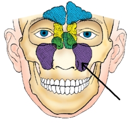 The sinus identified in the figure below is the:  