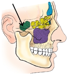 The sinus identified in the figure below is the:  