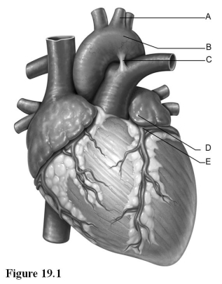 Use the diagram above to answer the following questions. -Identify the letter that indicates the left coronary artery.