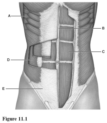 <strong>  Use the diagram above to answer the following questions. Identify the letter that indicates the serratus anterior.</strong> A) A B) B C) C D) D E) E <div style=padding-top: 35px> 