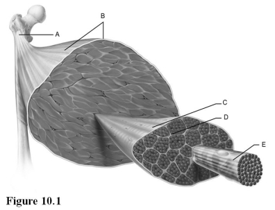 Use the diagram above to answer the following questions. -Identify the letter that indicates the epimysium.