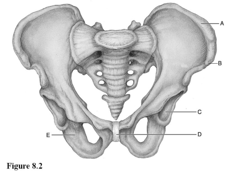 <strong> Use the diagram above to answer the following questions. Which letter indicates the bone that has tuberosities that are the strongest parts of the hip bones?</strong> A) A B) B C) C D) D E) E