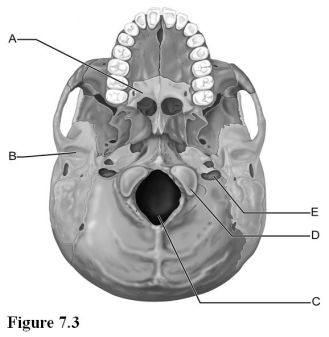 <strong> Use the diagram above to answer the following questions. Which letter indicates the mandibular fossa of the temporal bone?</strong> A) A B) B C) C D) D E) E