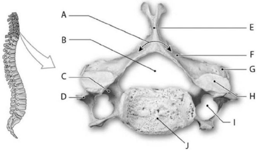 Photo Credit: Ralph T. Hutchings Figure 6-3 A Cervical Vertebra (Superior View) Use Figure 6-3 to identify the labeled part. -Structure B is the