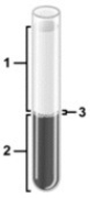 Predictions related to homeostatic imbalance, including disease states & disorders. -In the centrifuged sample of blood illustrated, what blood components are contained in the layer labeled number 3?