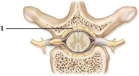 This figure shows a cross section of a vertebra and the spinal cord. What structure does number 1 indicate?  