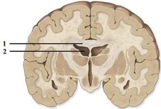 Division, origin, & function of component parts of the brain.   -This figure shows a frontal section of the cerebrum. What structure does number 2 indicate?