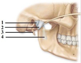 -This figure shows the temporomandibular joint. Which number indicates the sphenomandibular ligament?