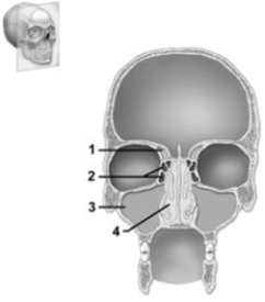<strong>Module F07 Gross anatomy of bones. This figure shows the major cavities within the skull. Which number indicates the sphenoid sinus?</strong> A) 1 B) 2 C) 3 D) 4 E) The sphenoid sinus is not shown on this figure.