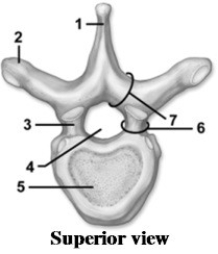-This figure shows a superior view of a vertebra. What feature is indicated by number 4?