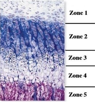 -This figure illustrates epiphyseal plate morphology. Which is the zone of proliferating cartilage?