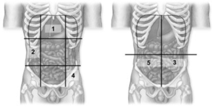-These figures show a frontal view of the abdominopelvic cavities. Which number indicates the left iliac region?