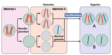 <strong>Which type of aneuploidy is represented in gametes labeled B in the figure? </strong> A) nullisomy B) monosomy C) trisomy D) tetrasomy