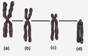 <strong>Which chromosome in the following figure is MOST likely to be described as acrocentric? </strong> A) (a) B) (b) C) (c) D) (d) E) Chromosomes (a) and (b) are both acrocentric.