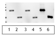 You are attempting to determine whether a plant-derived processed food sample (for example, a corn chip) contains material from a genetically modified organism (GMO). First, you crush the sample and attempt to extract DNA from it. Next, you perform PCR using two different sets of primers. One primer set will amplify a DNA sequence present in all plants. The second primer set will amplify a DNA sequence only found in GMO plants. a. Why must you use both sets of primers for this experiment? b. In addition to the test sample, you obtain a negative control sample (food material you are certain does not contain GMO material) and a positive control sample (food material you are certain does contain GMO material). You perform the DNA extraction on these three samples and then the PCR reactions with each of the two primer sets described above. Complete the following table with your expectations for this PCR reaction. c. You obtain the results shown in the panel below. What conclusions can you draw from these reaction results? Does this test sample contain genetically modified components? Why or why not?