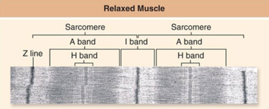 <strong>Shown below is an electron micrograph of part of a myofibril from a relaxed muscle fiber.Which of the labeled regions will NOT shorten when the muscle contracts?  </strong> A)A band B)Sarcomere C)H band D)I band <div style=padding-top: 35px> 