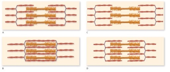 According to the figure,which one represents the muscle in an optimal condition for a strong contraction?