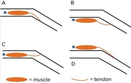 The figure below represents a joint in the hind leg of a grasshopper.The exoskeleton of the leg is indicated by the two pairs of parallel black lines.A muscle that moves this leg is fixed to the skeleton at the end marked with a blue star.When the muscle contracts,it will pull on the tendon at its opposite end.Which configuration shows the most likely arrangement of the exoskeleton and a muscle that increases the flexion of this leg?