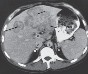 <strong>The adrenal glands are labeled: </strong> A)3. B)4. C)5. D)8.